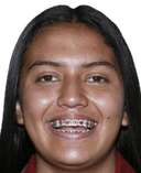 بريندا فيغا